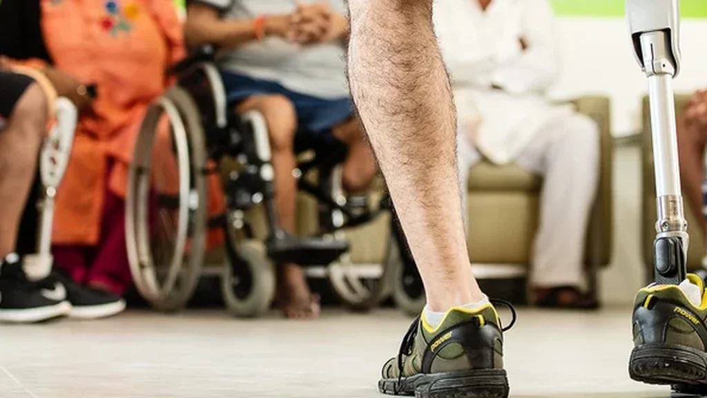 Bacak amputasyonu öncesi: Ayakta duran protez bacak kullanan kişi ve arkada rehabilitasyon grubu