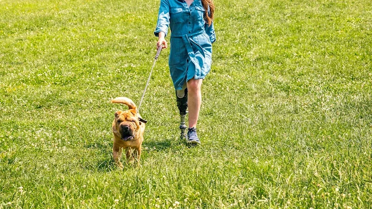 Günlük kullanım için çok yönlü protez ayak: Köpeğiyle yokuş çıkan bacak protezli kişi